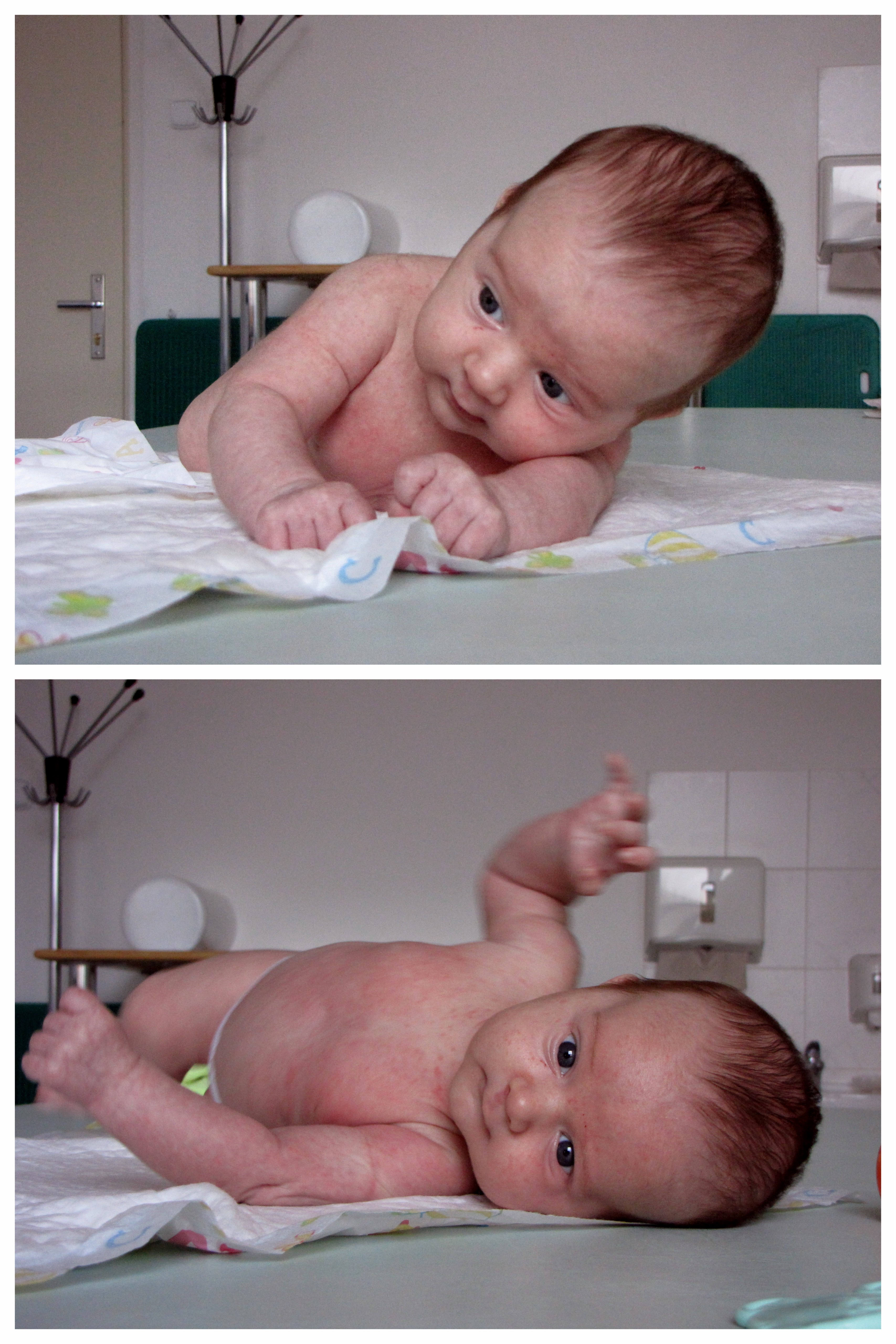 ilustrační foto: nestabilita kojence v poloze na břiše