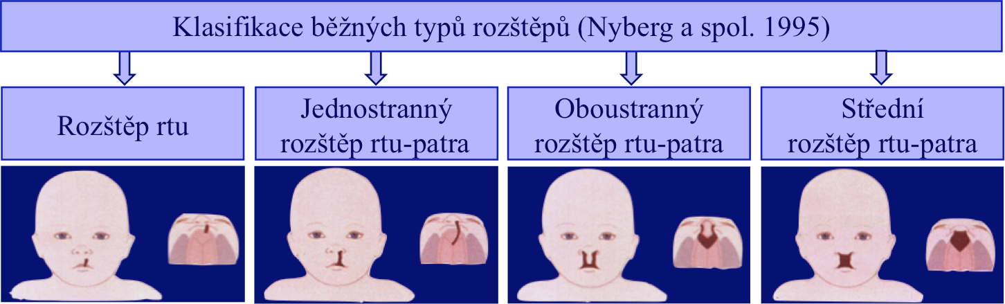 gynekologická klasifikace obličejových rozštěpů