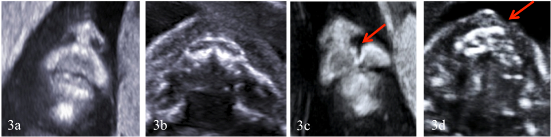 snímky z ultrazvuku