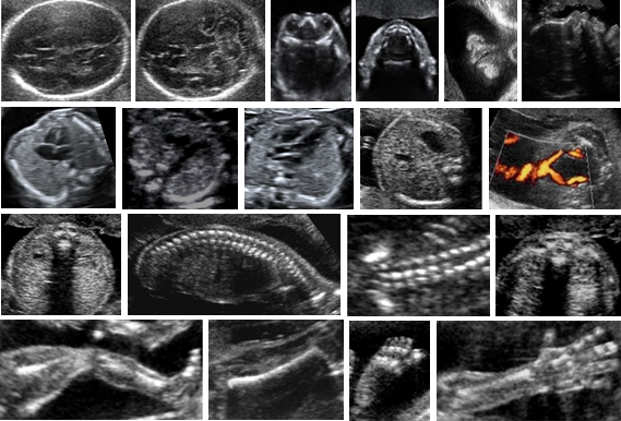 snímky z ultrazvuku