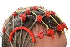 ilustrační obrázek - EEG vyšetření hlavy