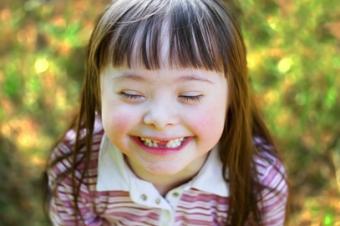 Holčička s Downovým syndromem Holčička s Downovým syndromem