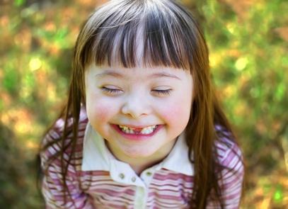 Holčička s Downovým syndromem Holčička s Downovým syndromem