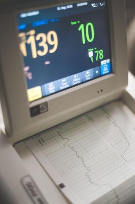 EKG plodu