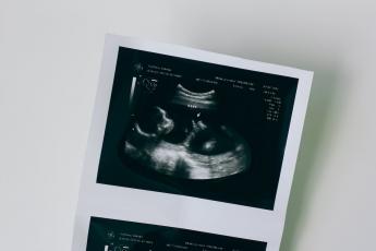Ultrazvuk dítěte