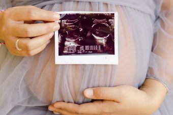 Těhotenské bříško a ultrazvukový snímek